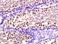 HSP70 Mouse mAb